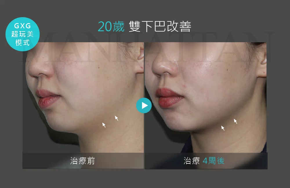 超完美電波 案例 01