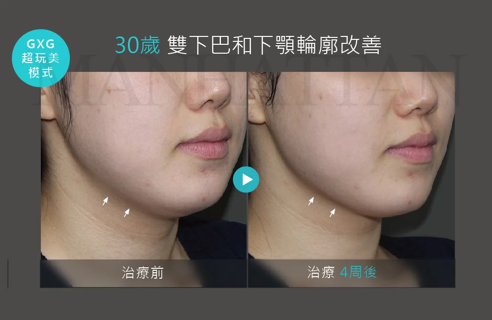 超完美電波 案例 02