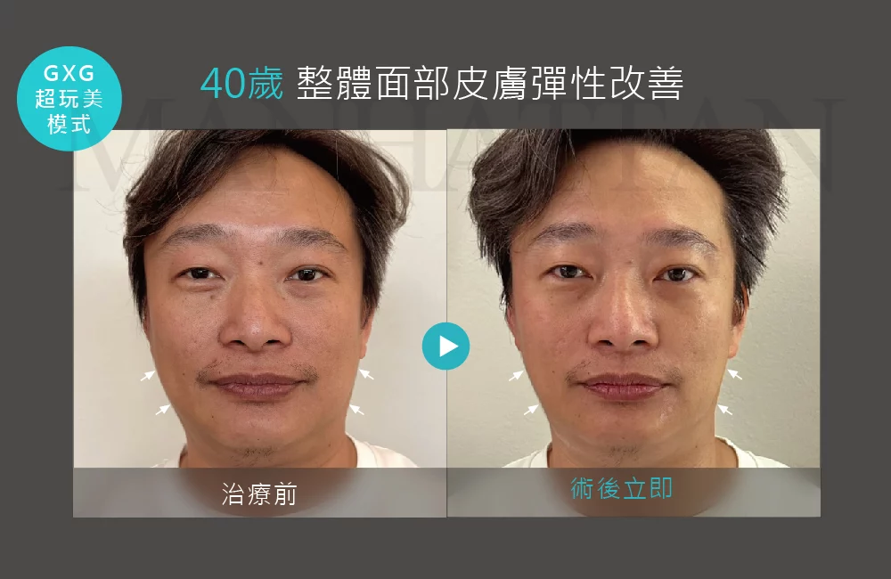 超完美電波 案例 03