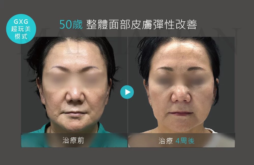 超完美電波 案例 04