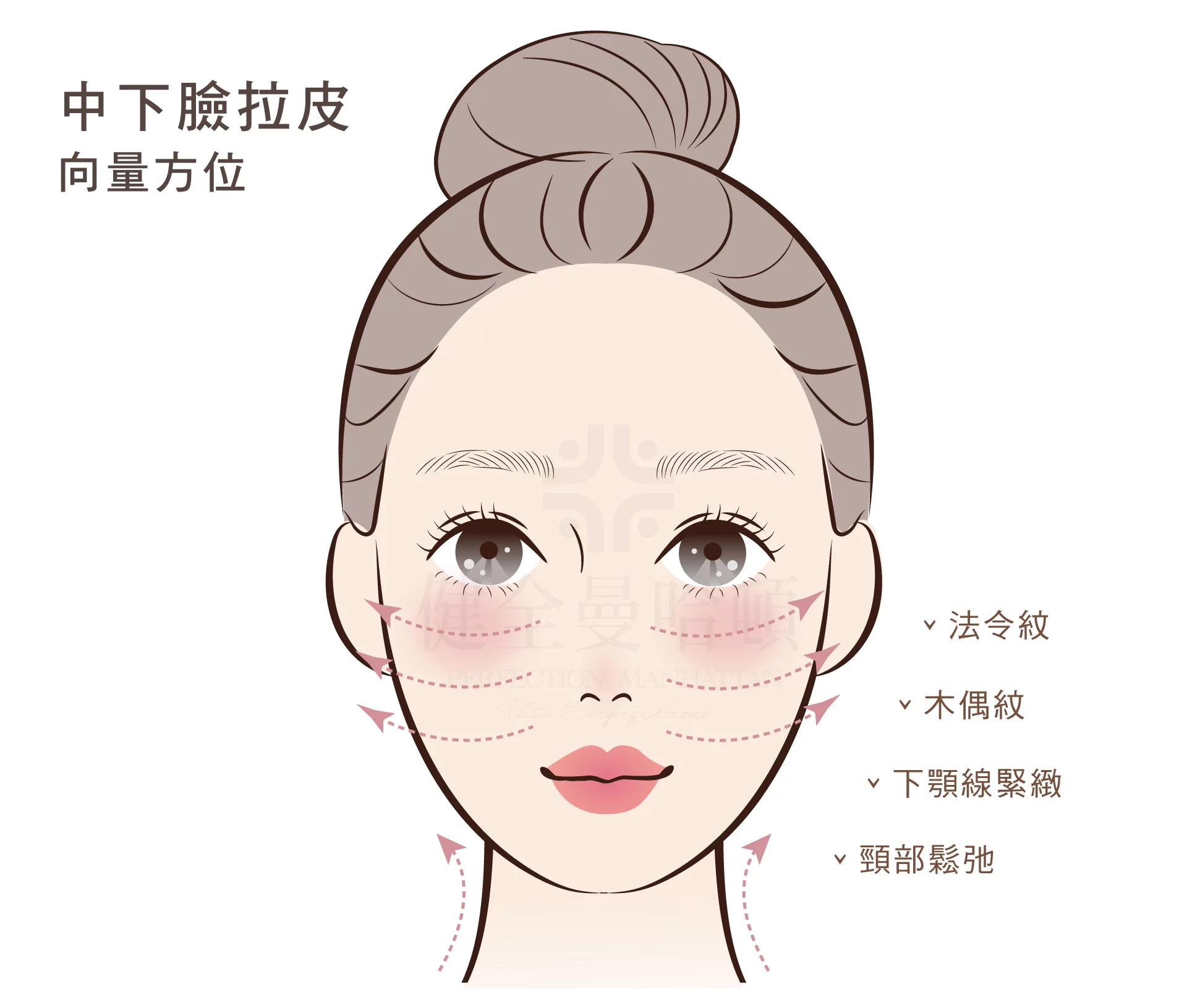 顳側拉皮 中下臉拉皮