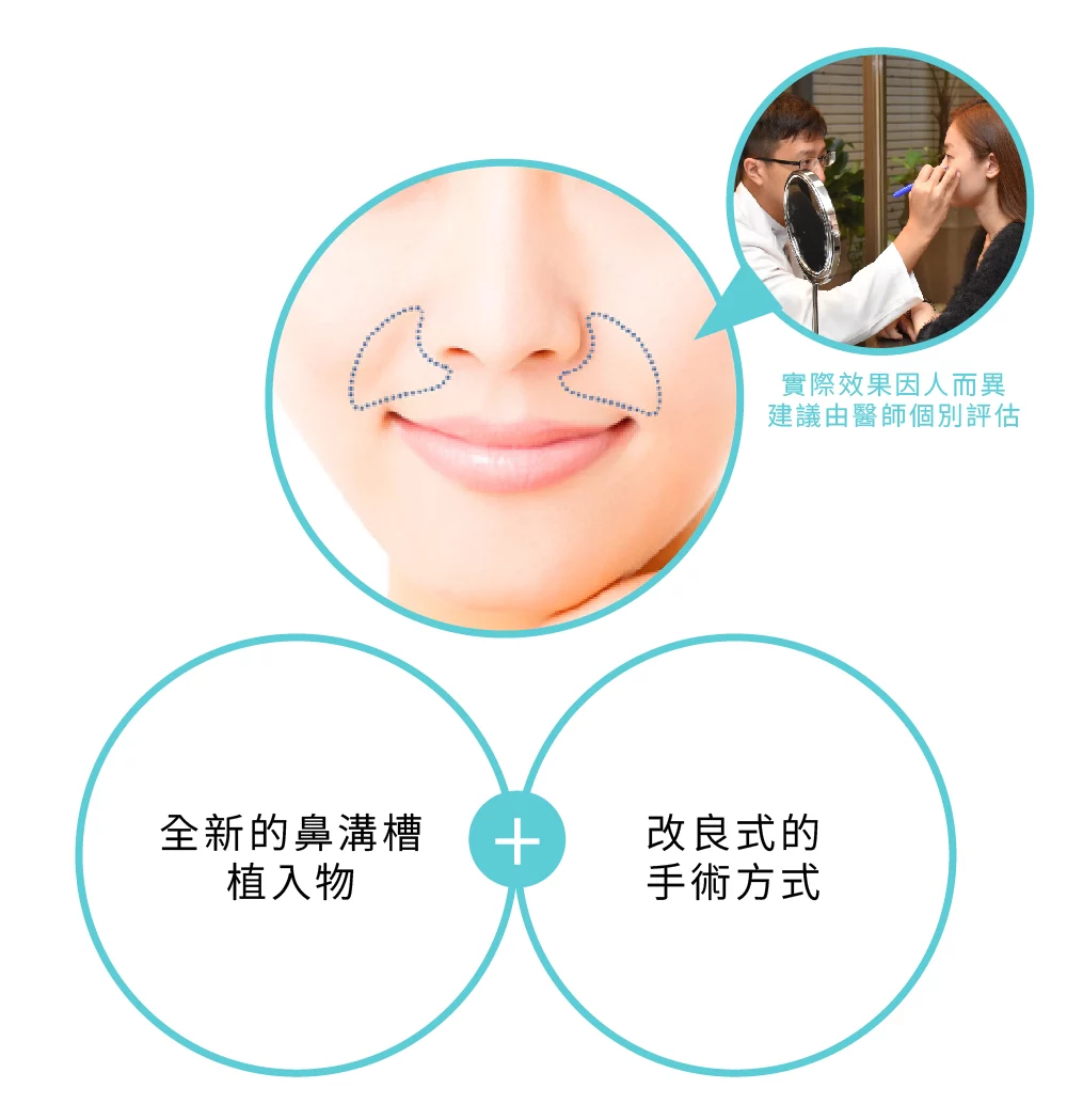 鼻溝槽 鼻溝槽 01