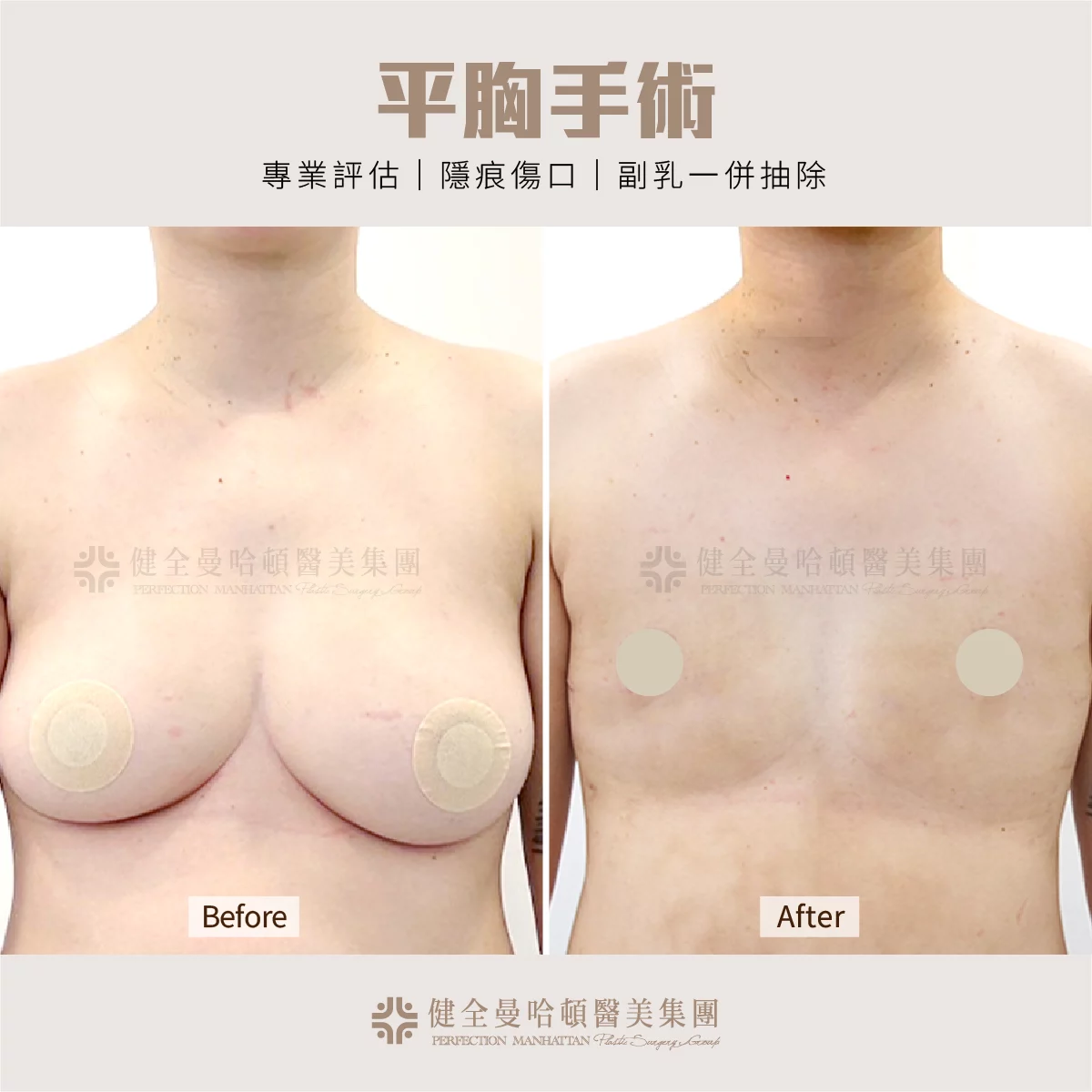 BA 王可欣 平胸 03