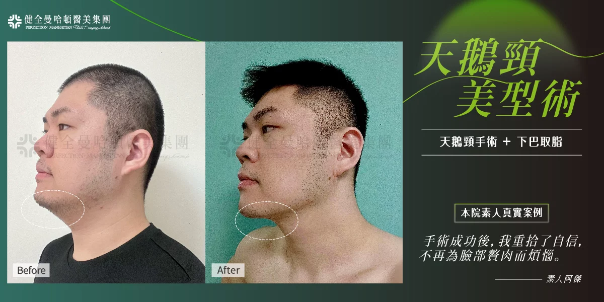 傅韋傑 天鵝頸 01