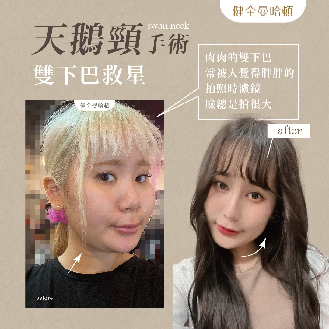 天鵝頸 張瓅勻 02