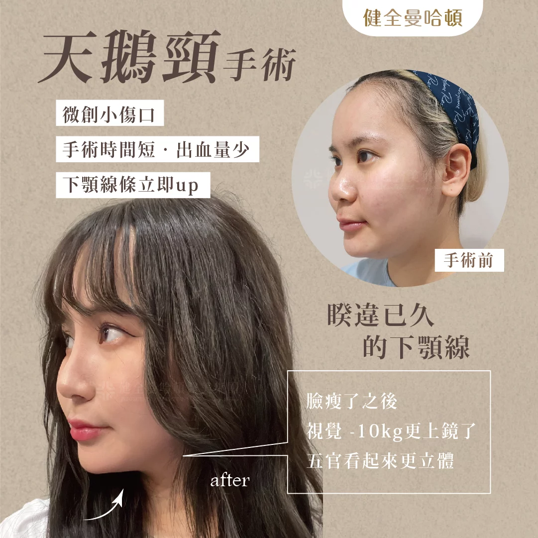 天鵝頸 張瓅勻 04