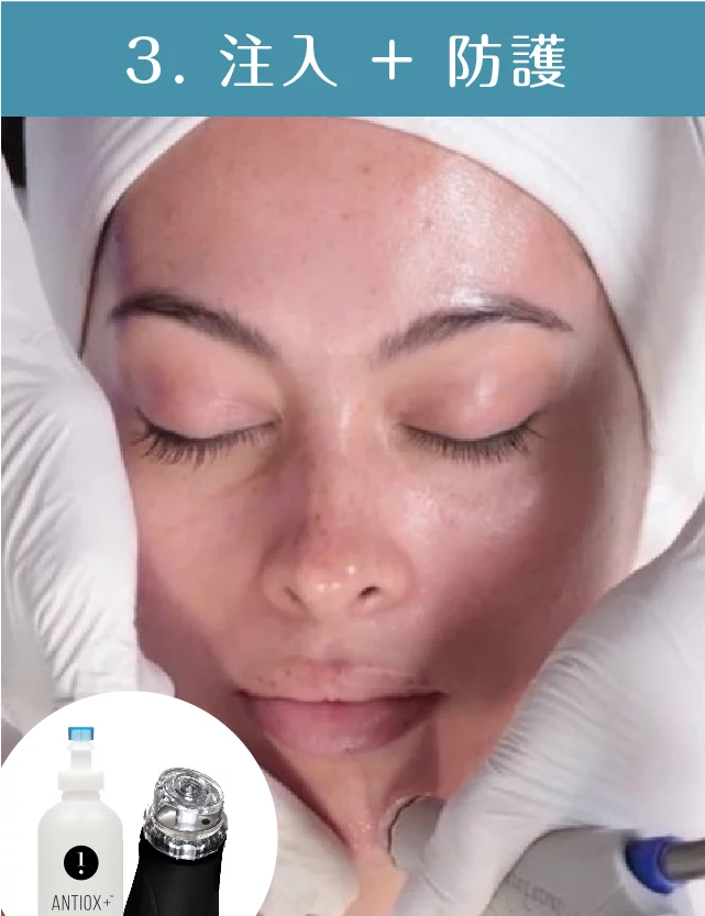 海菲秀 注入防護 1